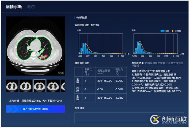 百度「AI戰(zhàn)疫」：首次開源肺炎CT影像分析模型，讓診斷從分鐘到秒